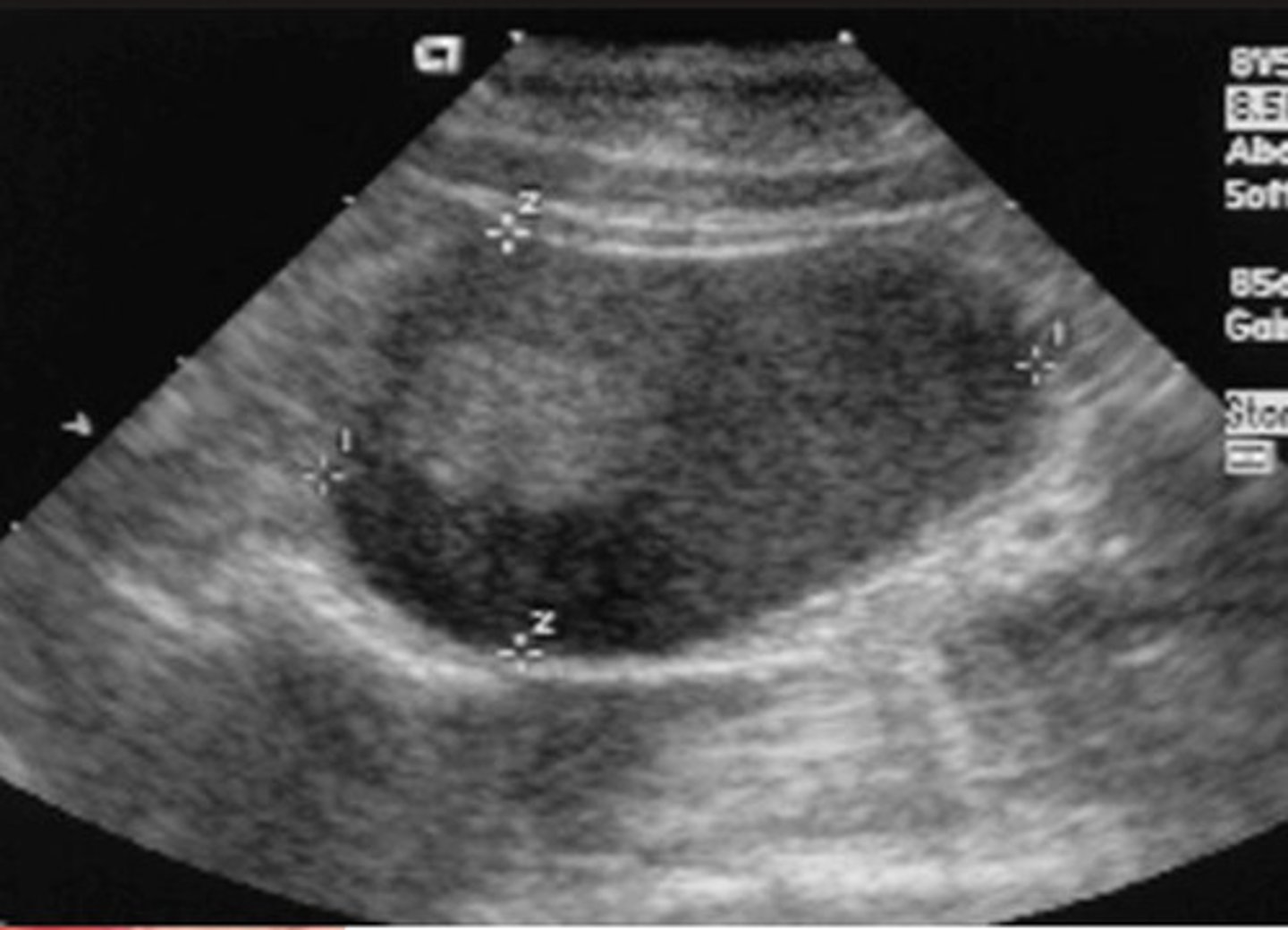 <p>which abnormality is this?</p>