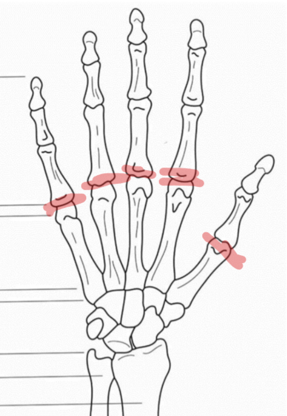 <p>Hoe noemt het gewricht dat tussen de metacarpalen en proximale falangen ligt</p>
