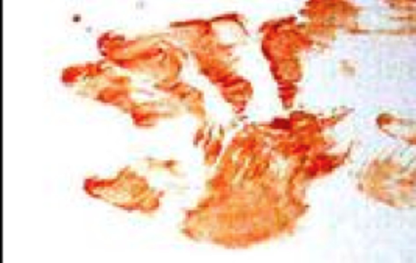 <p>A pattern created when a wet, bloody surface comes in contact with another surface to form a print-like pattern</p>