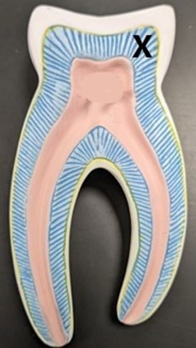 <p>ID the Internal Tooth Structure</p>