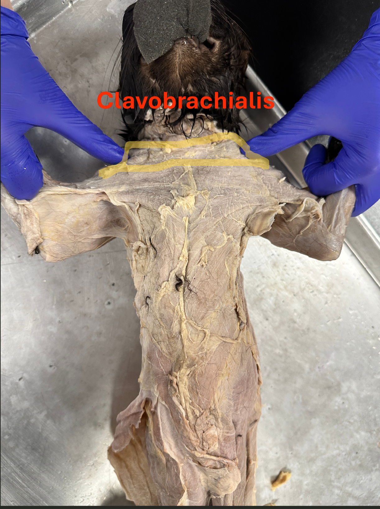 <p>Clavobrachialis (clavo bra kee alis) (Anterior shoulder and chest)</p>