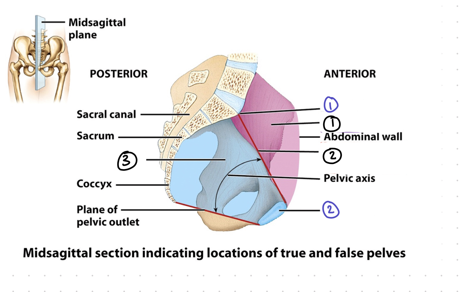 <p>true vs. false pelvis - 1 purple </p>