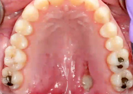 <p>what is the diagnosis </p>