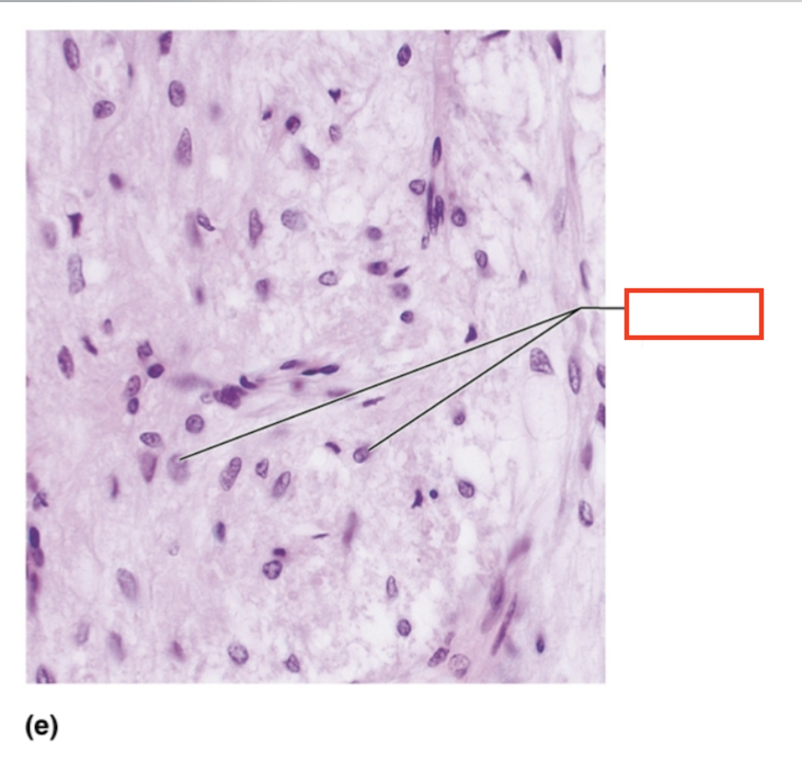 <p>What structure is highlighted?</p>