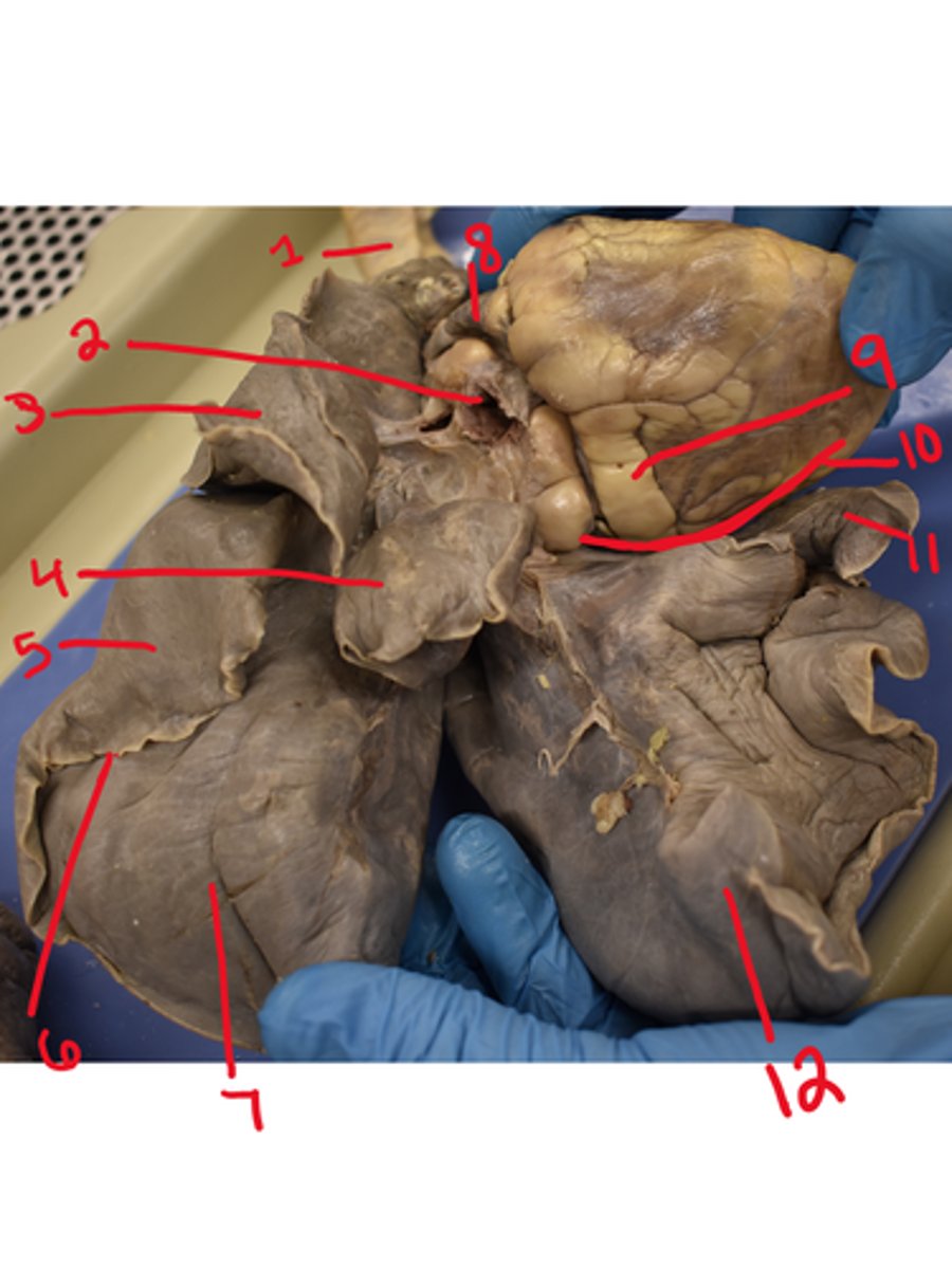 <p>What is structure #1</p>