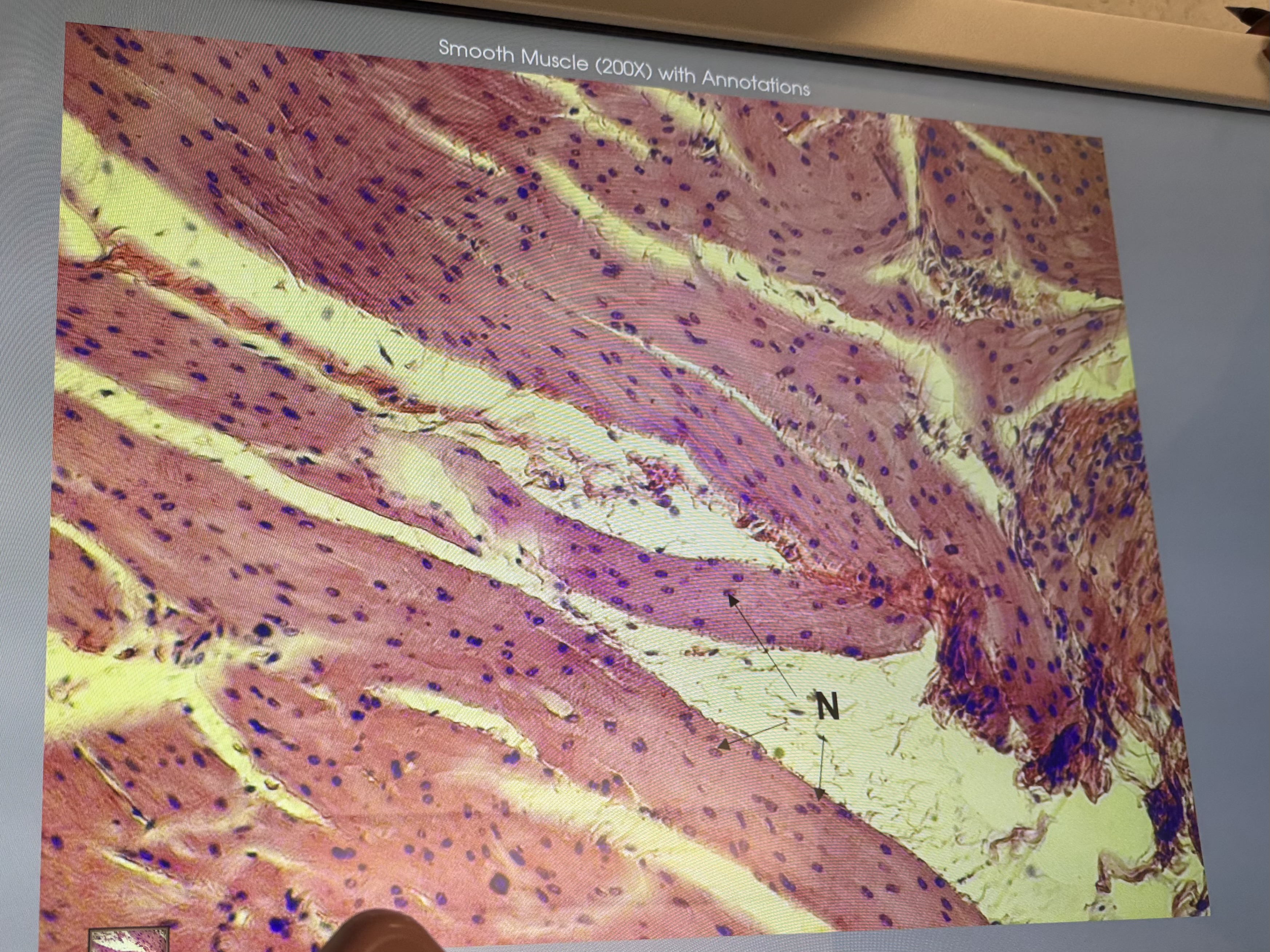 <p>Esophagus (#10937): smooth muscle, shape?, striated or not?, single or multinucleated?</p>