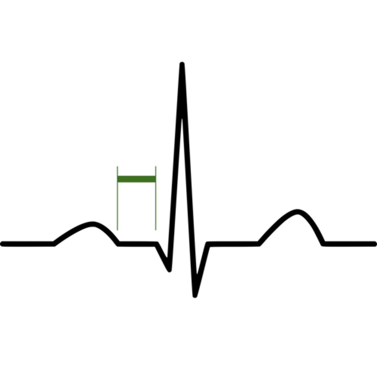 <p>end of atria diastolic period and ventricles are beginning of systolic phase</p>