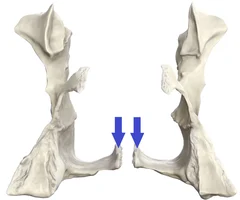 <p>Posterior View</p>