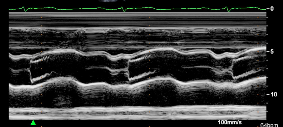 <p>Identify this image. </p>