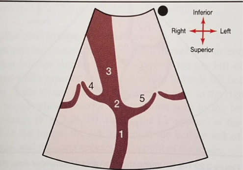 <p>What is number 1?</p>