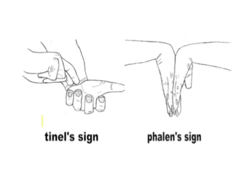 <p>64 y/o female presents to the clinic for pain and numbness of her thumb, index, and middle finger that worsens at night. On physical exam you note a weakened grip, thenar atrophy, a positive phalen and tinel’s. What diagnostics do you want?</p>