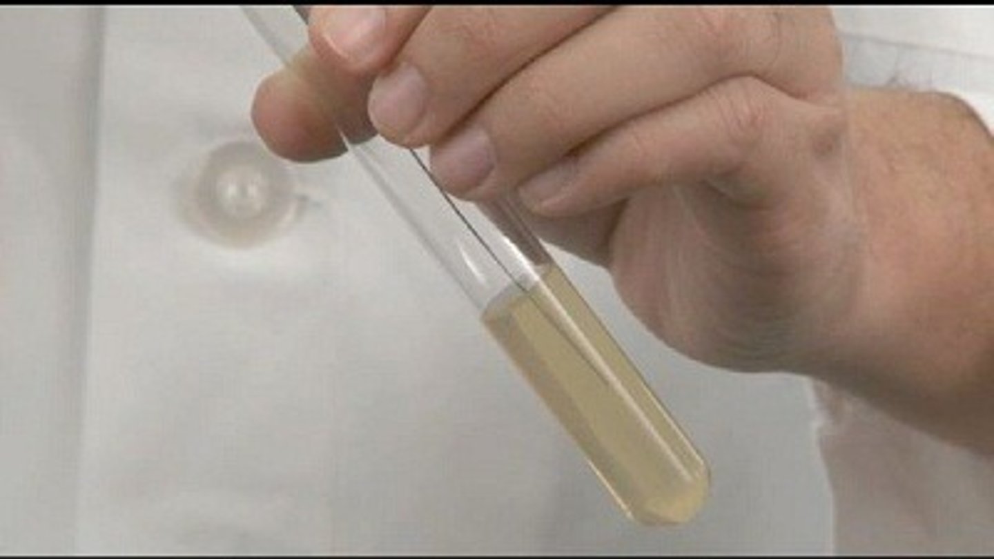 <p>Transferring of cultures in solid media and making stabs and smears</p>