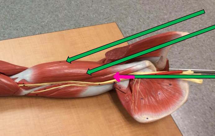 <p>Identify this muscle?</p>