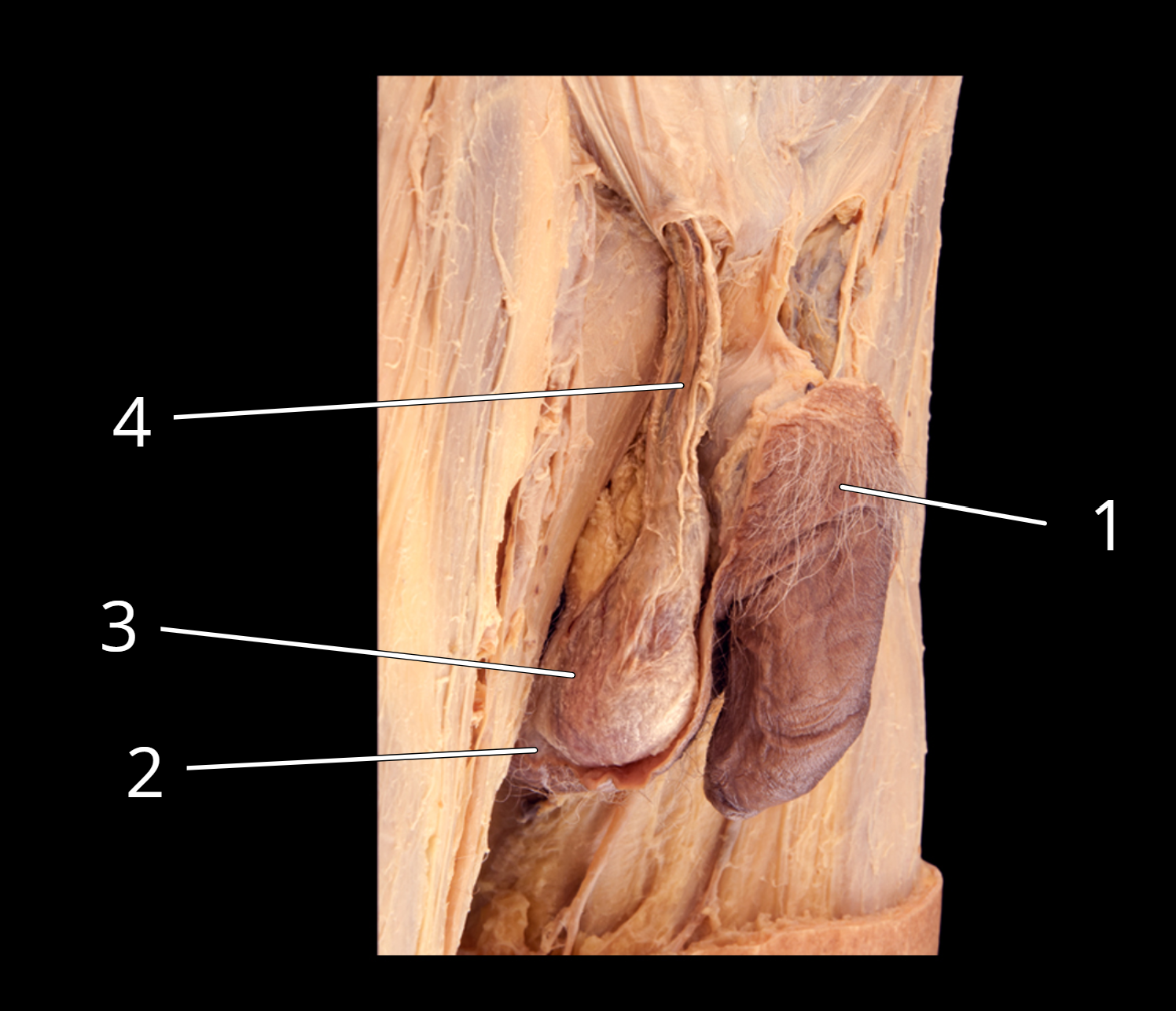 <p>Penis and testis, lateral view</p>
