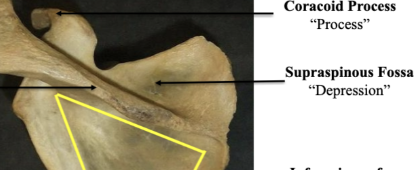 <p>Supraspinous Fossa</p>