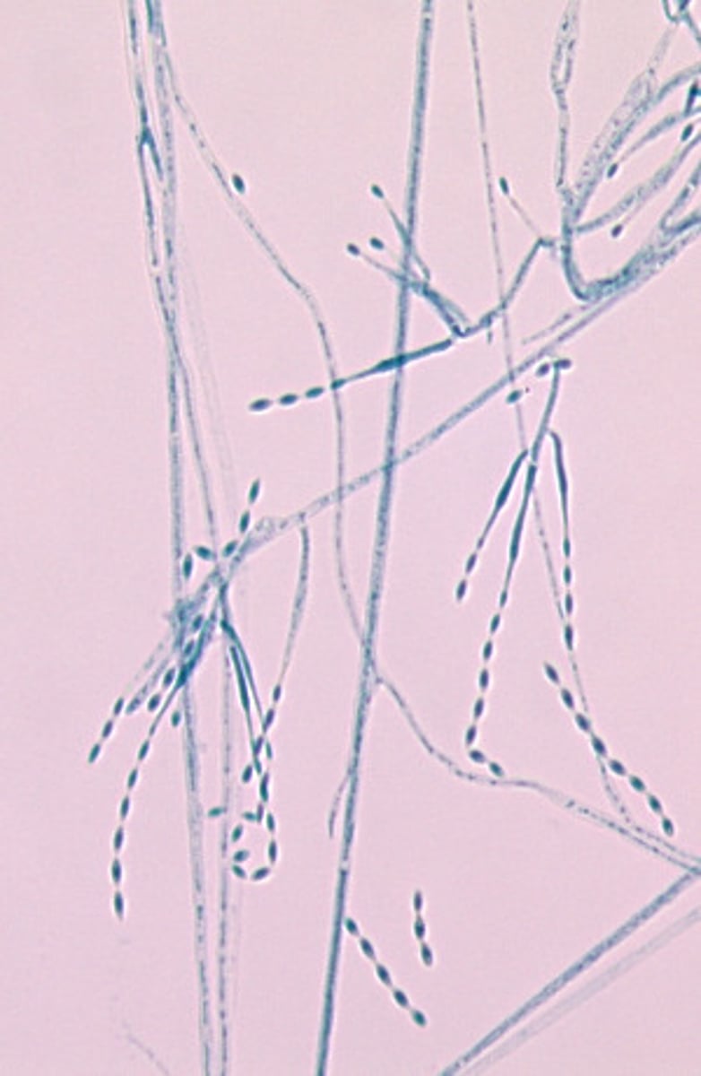 <p>Paecilomyces spp. produce widely-spaced, elongated, slender phialides bearing chains of oval conidia.</p>