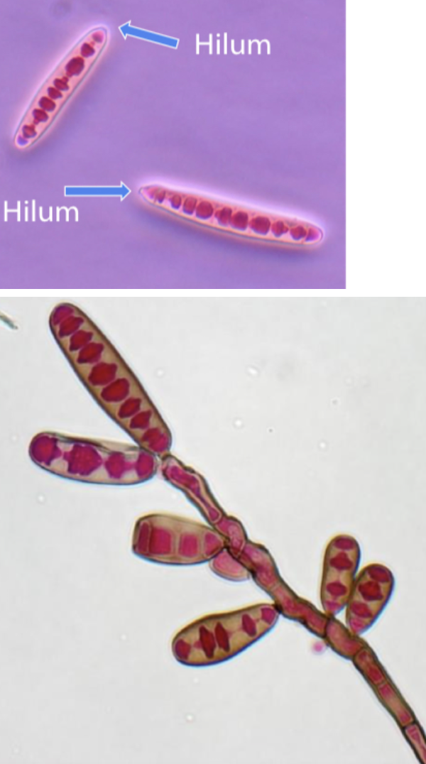 <p>Exserohilum rostratum</p>