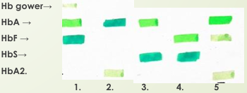 <p>Ejercicio</p>