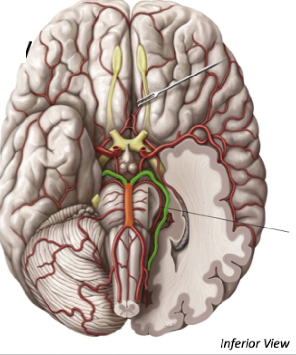 <ul><li><p><span style="color: yellow">Basilar Artery</span> bifurcates into the <span style="color: green">2 Posterior Cerebral arteries</span></p></li><li><p>These arteries supply the posterior cerebral cortex</p></li></ul>