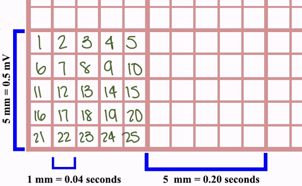 <p>25 small squares</p>