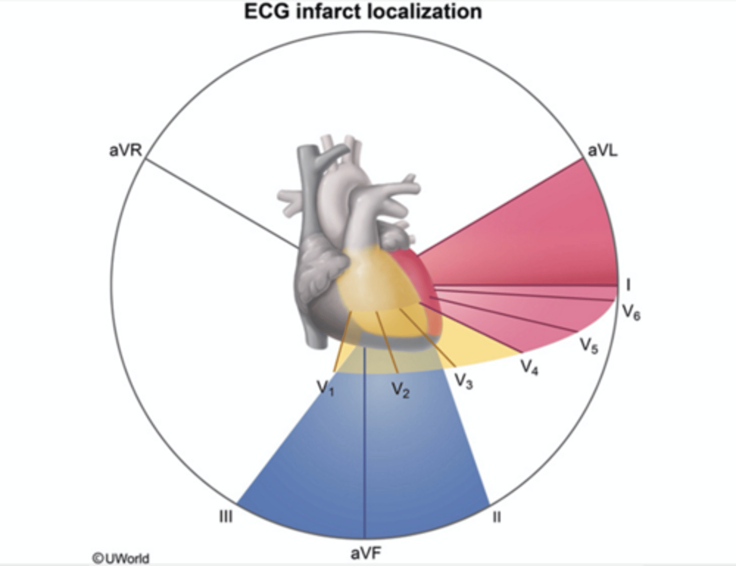 <p>- MI frequently named by location</p><p>- can provide clues to the culprit vessel</p>