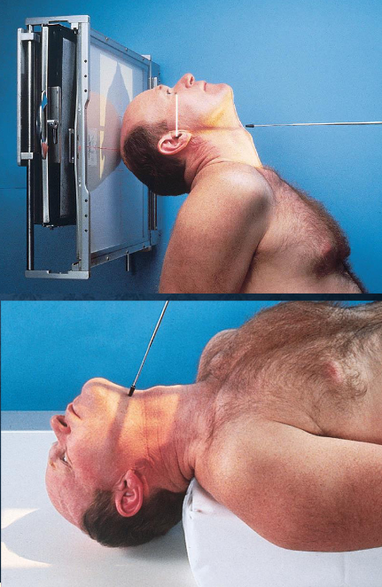 <ul><li><p>patient position:</p><ul><li><p>upright (seated) or supine (torso elevated)</p></li></ul></li><li><p>part position:</p><ul><li><p>MSP centered to midline</p></li><li><p>MSP perpendicular to IR</p></li><li><p>IOML parallel with IR</p></li><li><p>patient hyperextends neck and rests head on vertex</p></li></ul></li><li><p>respiration suspended</p></li><li><p>CR:</p><ul><li><p>perpendicular through sella turcica and IOML</p></li><li><p>enters MSP of throat between angles of mandible (gonion)</p></li><li><p>passes through a point ¾ inch anterior to the level of the EAM</p></li></ul></li><li><p>collimation:</p><ul><li><p>½ inch beyond the shadow of the tip of the nose and 1 inch beyond the lateral borders</p></li></ul></li></ul><p></p>