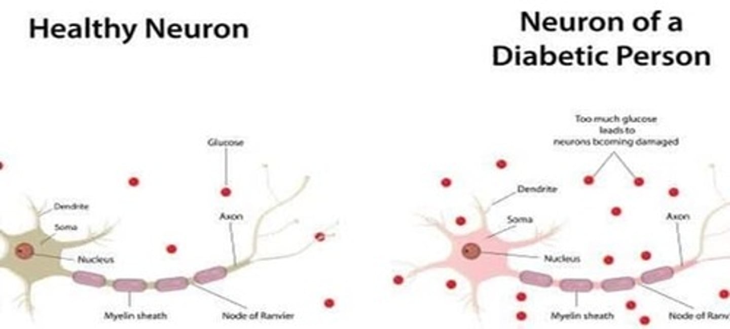 <p>7-10% of population</p><p>more common in women</p><p>more common age 50+</p><p>most commonly cervical/ lumbar radiculopathy (but we're not covering this bc it is acute, treatment is usually short, and involves surgery, PT)</p>