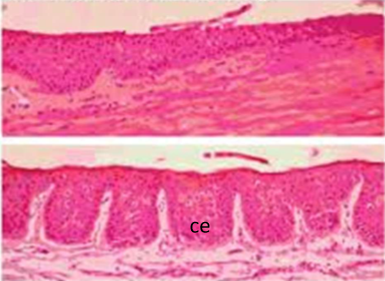 <ul><li><p>radially oriented fibrovascular channels between ridges of thickend conjunctival epithelium</p></li><li><p>fibrovascular channels contain, arterial, venous, and lymphatic vessels</p></li><li><p>more prominent at superior and inferior limbus</p></li></ul><p></p>