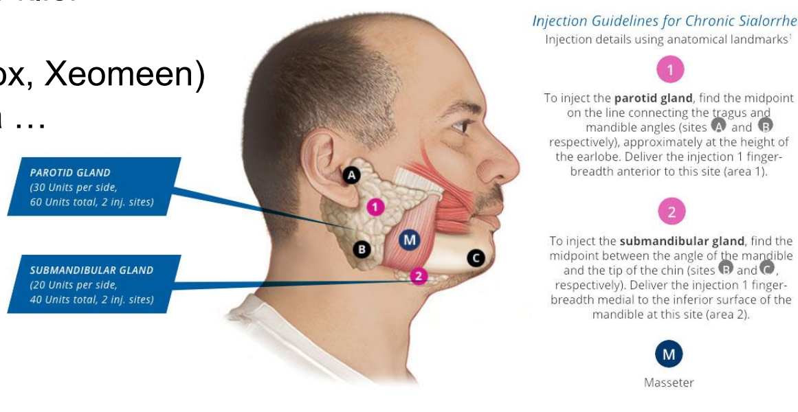 <p>Palpation vs landmarks vs ultrasound </p><p>Totaaldosis, Dilutievolume </p><p>Dosisverhouding per klier </p><p>Preparaat </p><ul><li><p>incobotuline (Botox, Xeomeen) vs onabotuline ea …</p></li></ul><p></p>