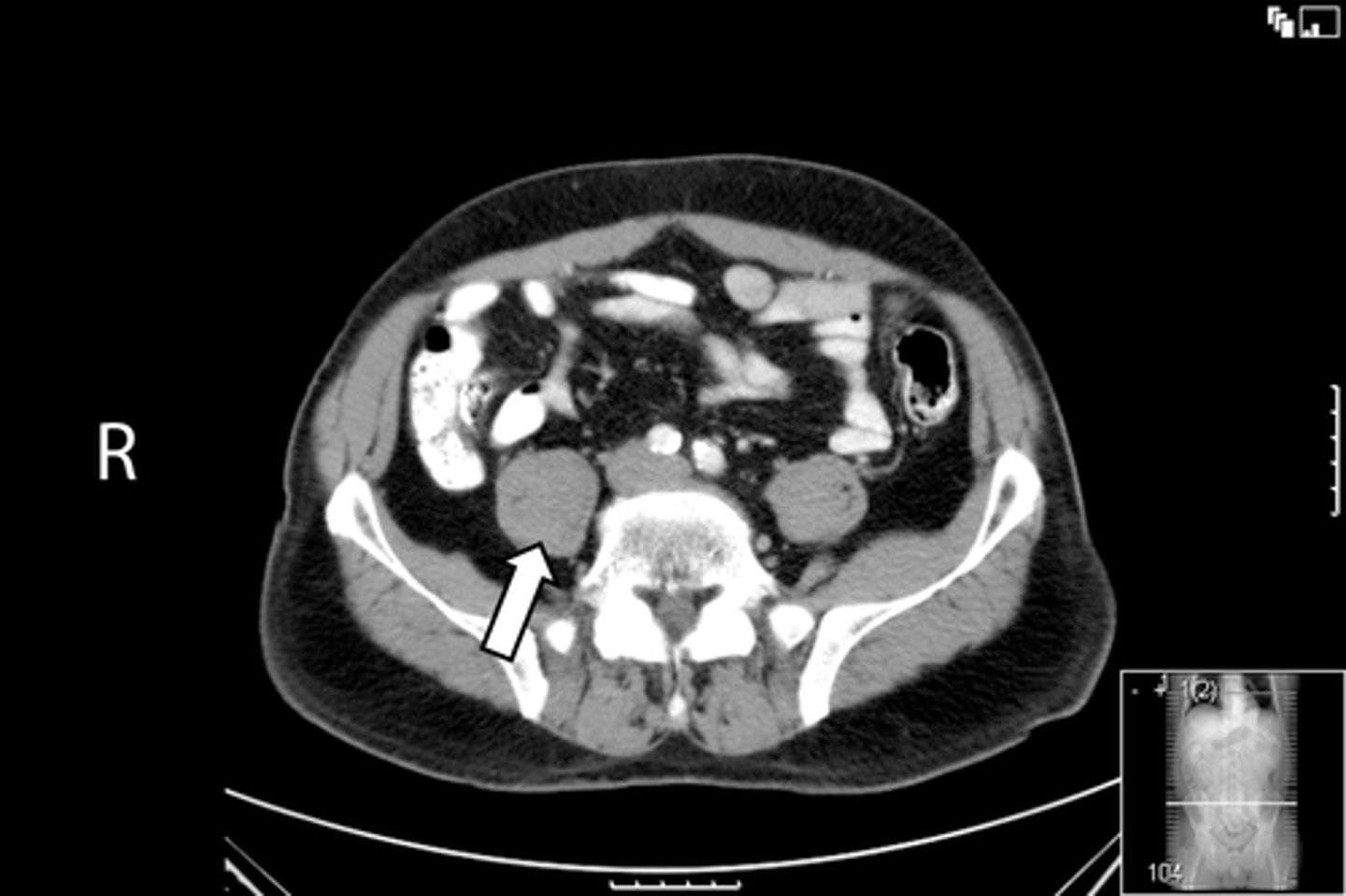 <p>What is indicated in the image?</p>