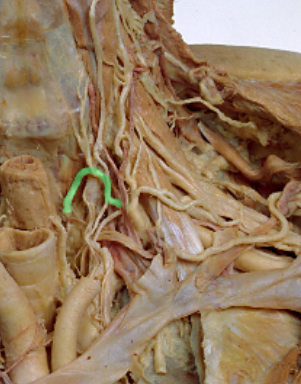 <p>Which artery?</p>