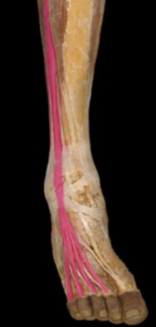 <p>lateral side of tibialis anterior</p>