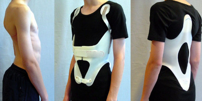 <p>- components: </p>
<ul>
<li>pelvic and thoracic band </li>
<li>posterior uprights </li>
<li>lateral uprights </li>
<li>abdominal support </li>
<li>cowhorn extension </li>
</ul>
<p>- functions: </p>
<ul>
<li>restrict flexion, extension (lumbar only), lateral flexion, and rotation</li>
</ul>