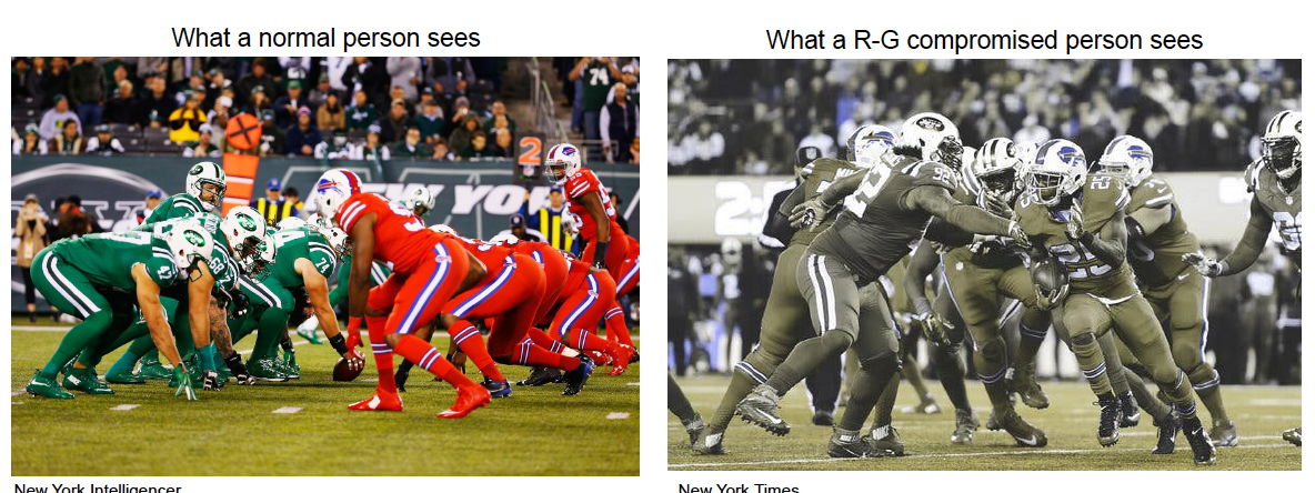 <p>types of inherited color vision deficiencies</p>