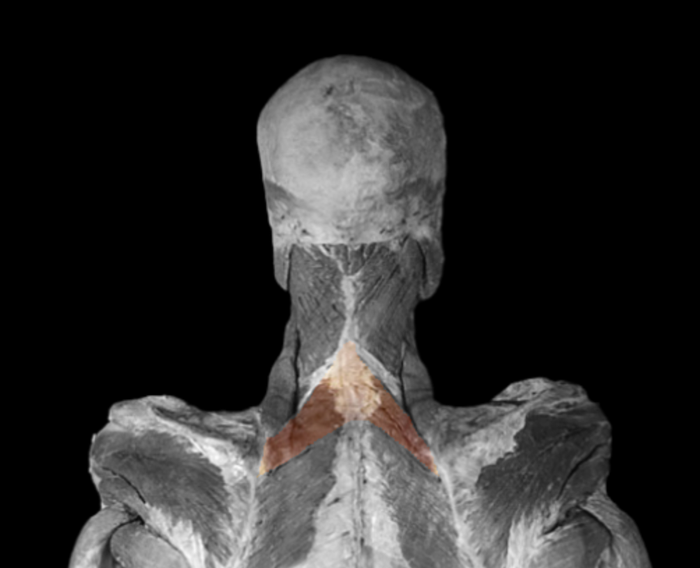 <p>What muscle is this? </p>