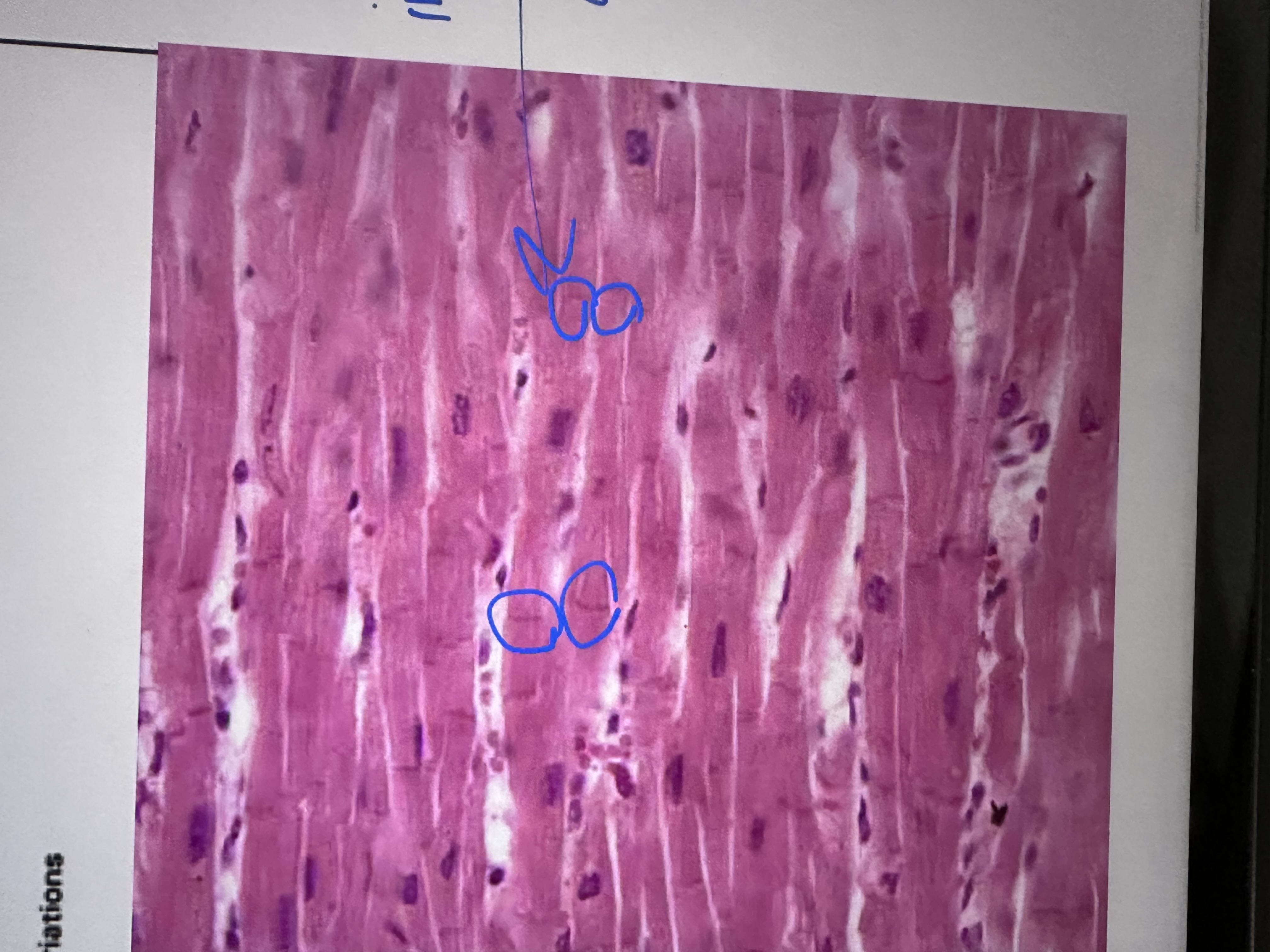 <p>Involuntary, striated , branched , single nucleus, joined by interolated discs, helps with synchrony  of contractions HEART ONLY </p>