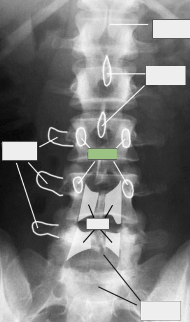 <p>What is referenced by the box highlighted in green?</p>