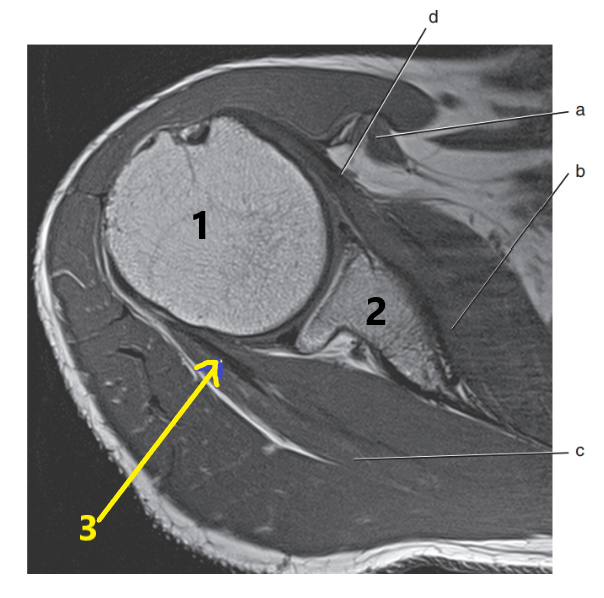 <p>What is letter d ?</p>