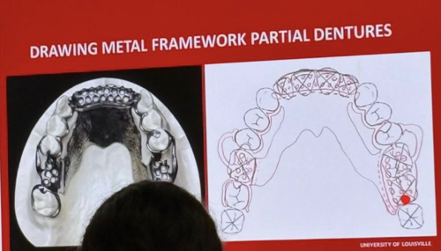 <p>-the drawing is correct</p><p>-there are 3 internal finish lines and 3 external</p>