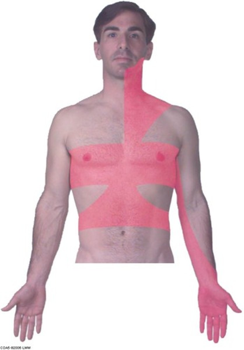 <p>referred pain of what structure?</p>