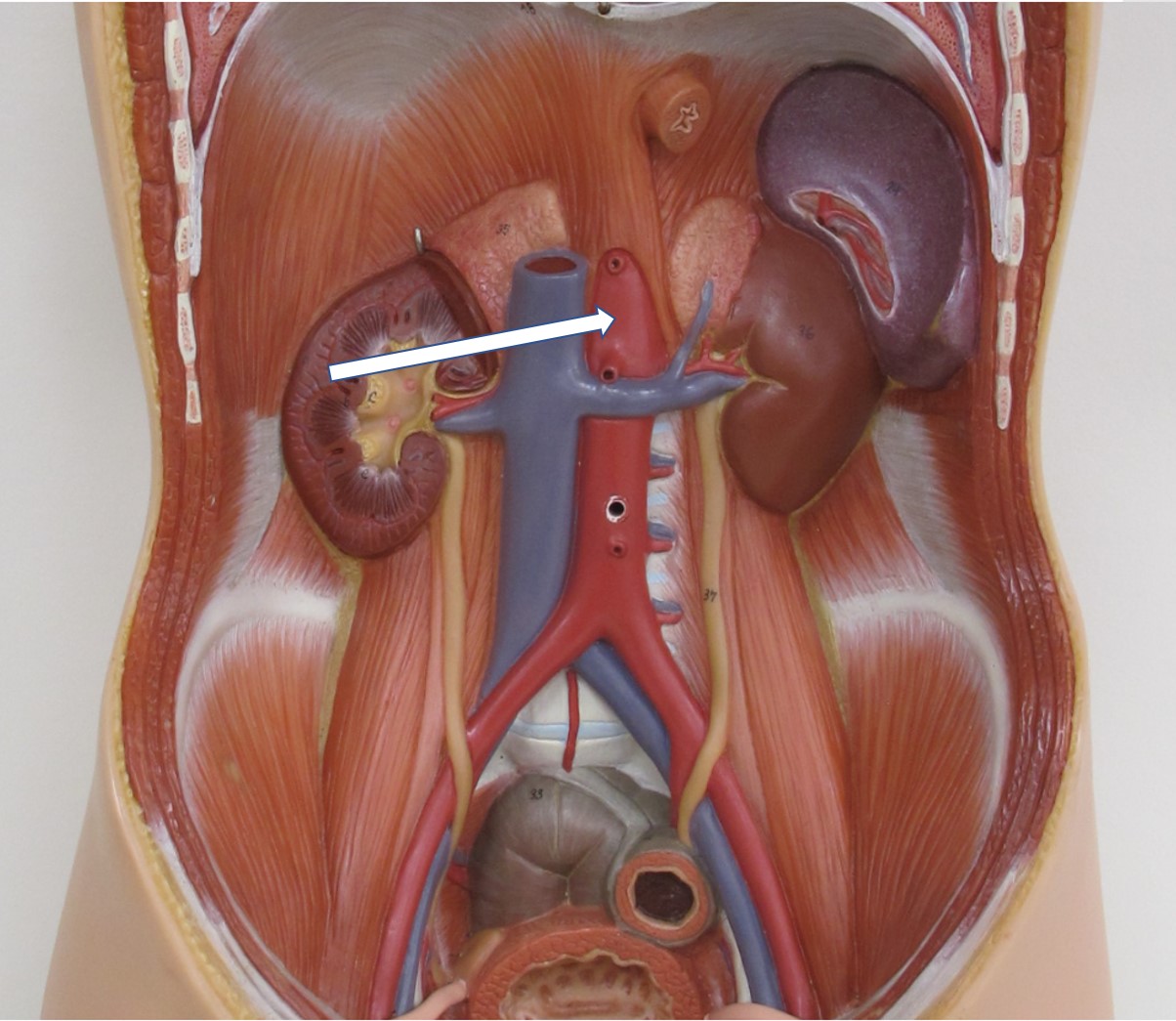 <p>bloedvat (specifiek)</p>
