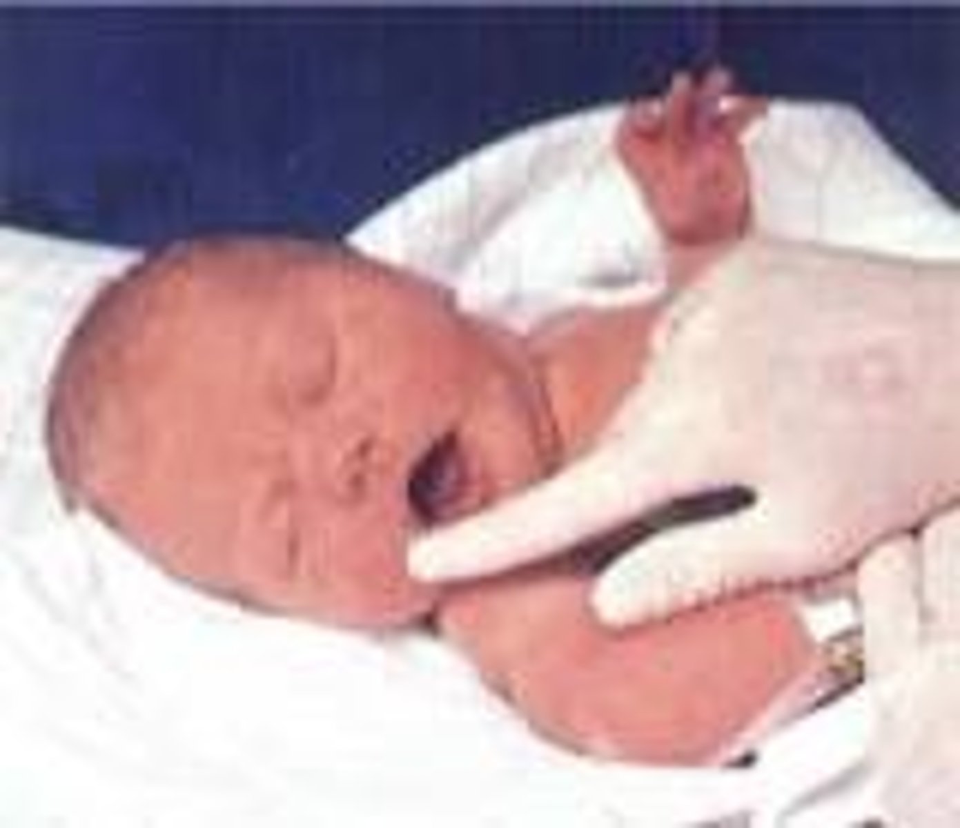 <p>automatic response in newborns where they turn their head toward a touch on the cheek, helping them locate and latch onto the mother's breast for feeding.</p>