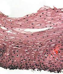 <p>a type of tissue found in the body. It consists of multiple layers of flat, scale-like cells. This type of epithelium is commonly found in areas that experience wear and tear, such as the skin, mouth, esophagus, and vagina. Its main function is to provide protection against mechanical stress, abrasion, and pathogens.</p>