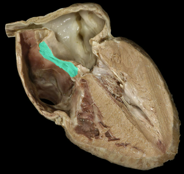 <p>Interatrial septum</p>