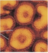 <p>Genus-Influenza virus</p>