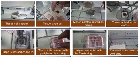consists of two modules that together create an ergonomic workstation for the production of paraffin blocks. The user can position the individual modules from either left to right or right to left, depending on personal preference.

* Using a tissue trek system the tissue can now be further processed
* Cooling down of paraffin

  