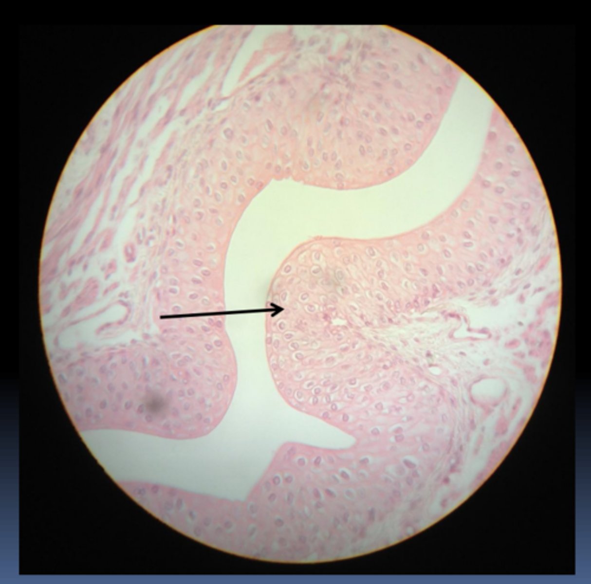 <p>What is this particular subtype?</p>