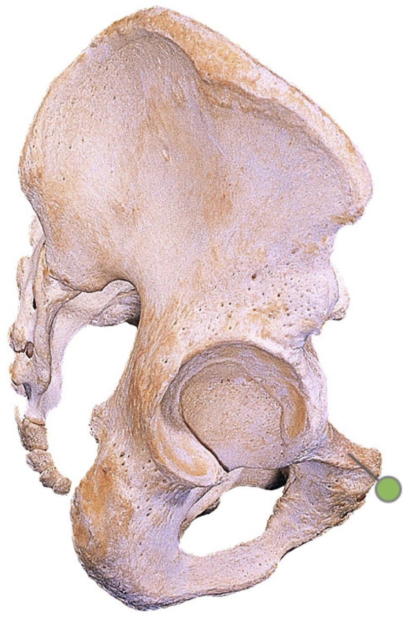 <p>Which bone landmark of the pelvic girdle is a small, forward-projecting bump on the medial front?</p>