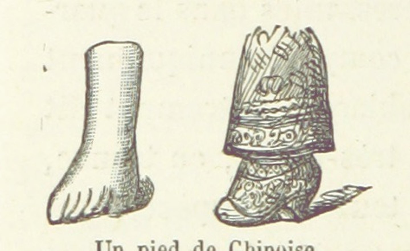 <p>Practice in Chinese society to mutilate women's feet in order to make them smaller; produced pain and restricted women's movement; made it easier to confine women to the household.</p>