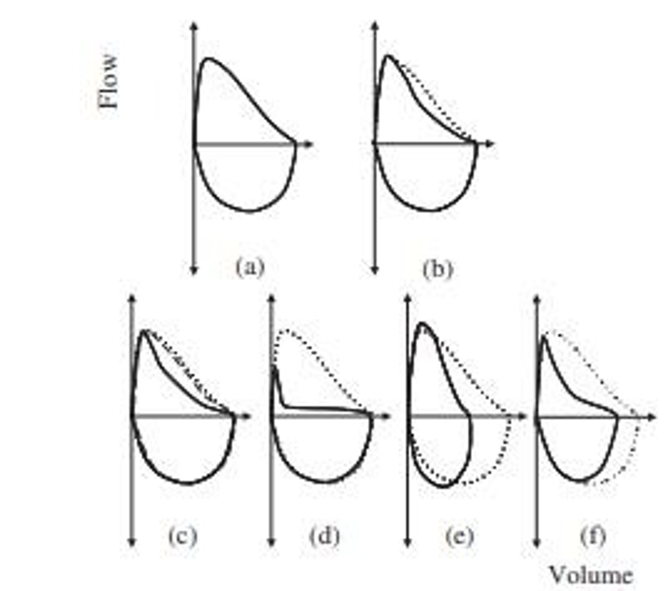 <p>To visualize airflow patterns and identify obstructive or restrictive lung diseases.</p>